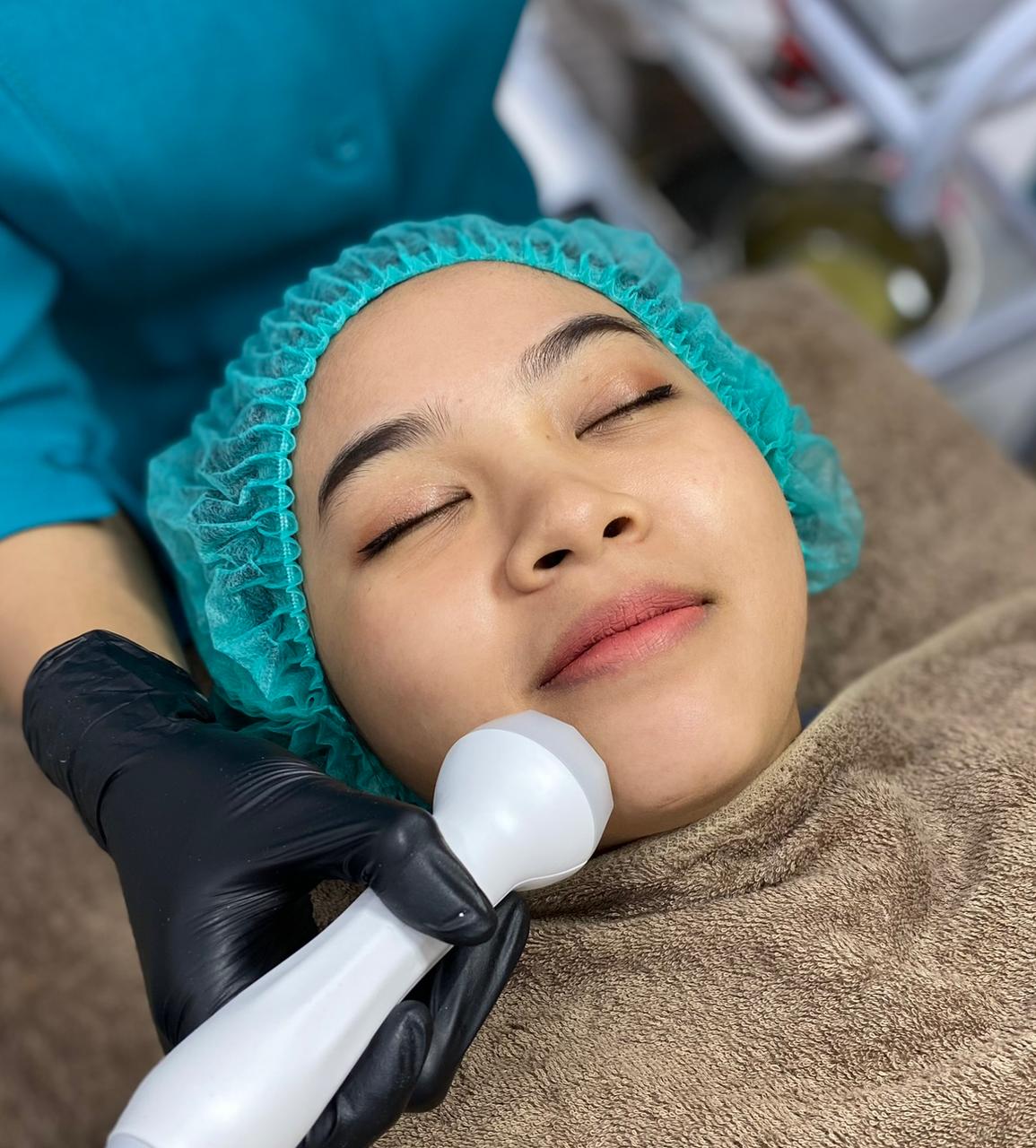 Facial Radiofrequency Face