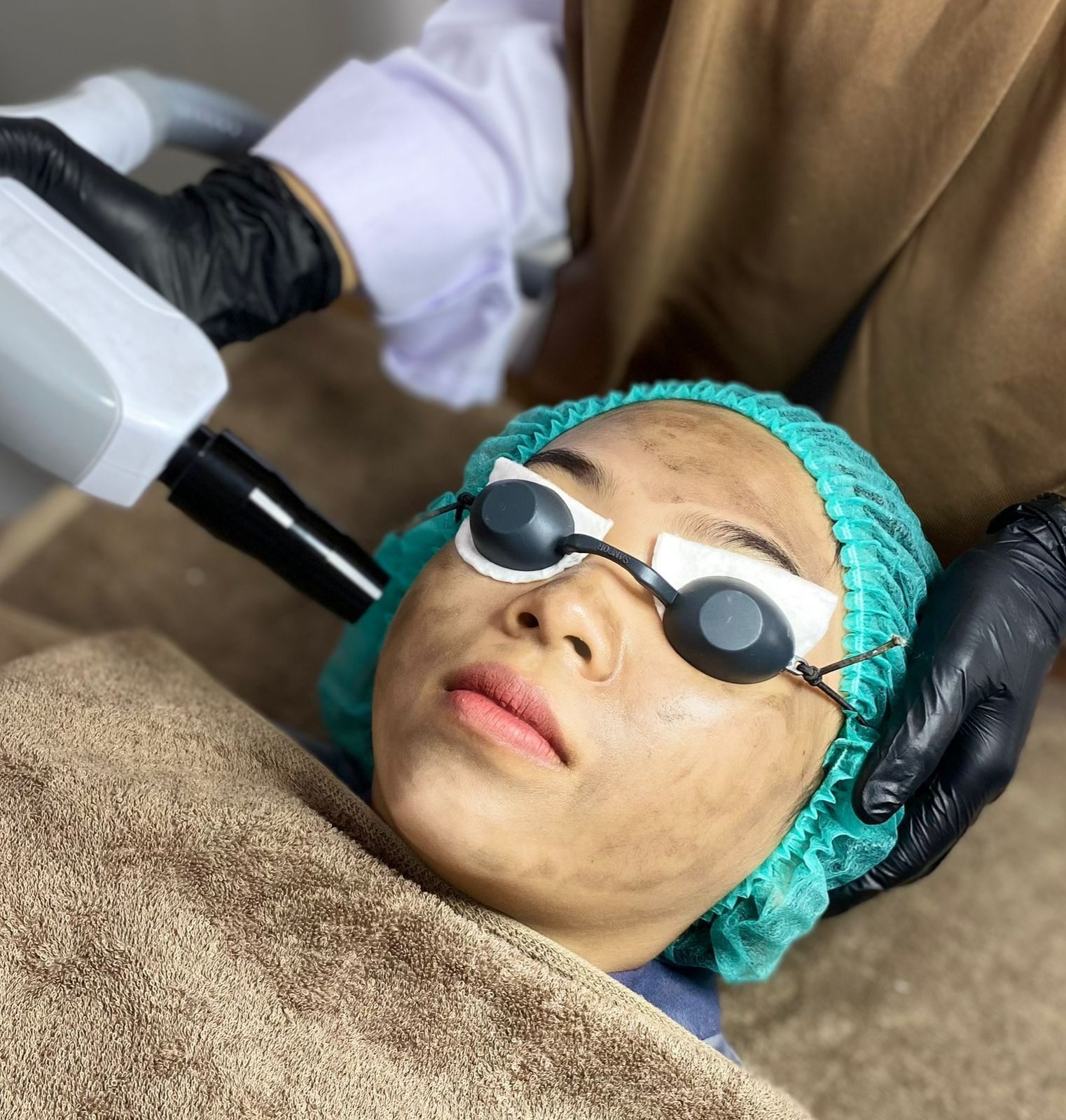 Laser Pico Korea Blackdoll