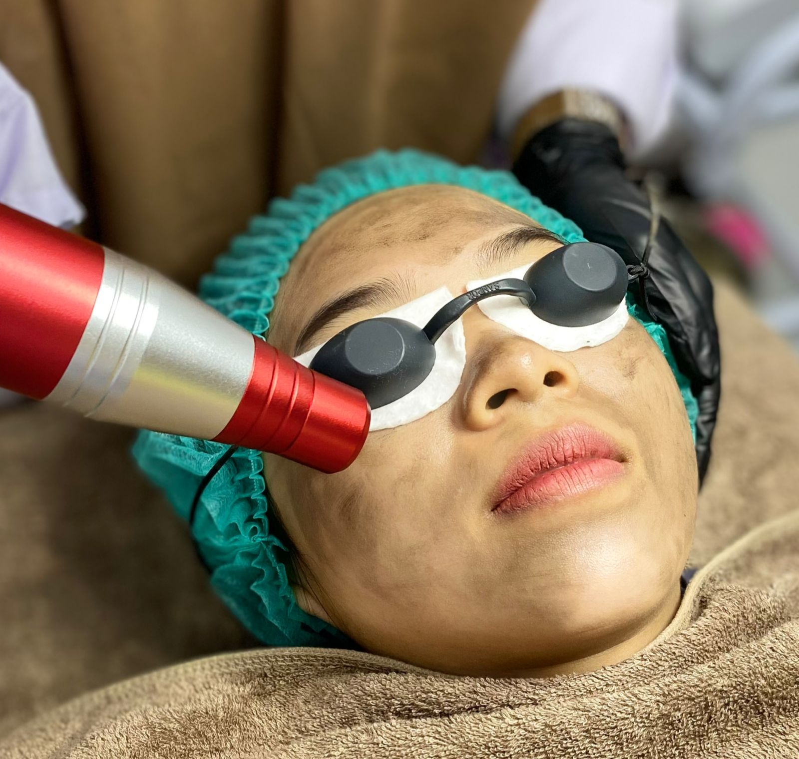 Laser Picosecond Blackdoll