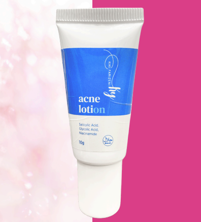Acne Lotion By Kiki Farizeni